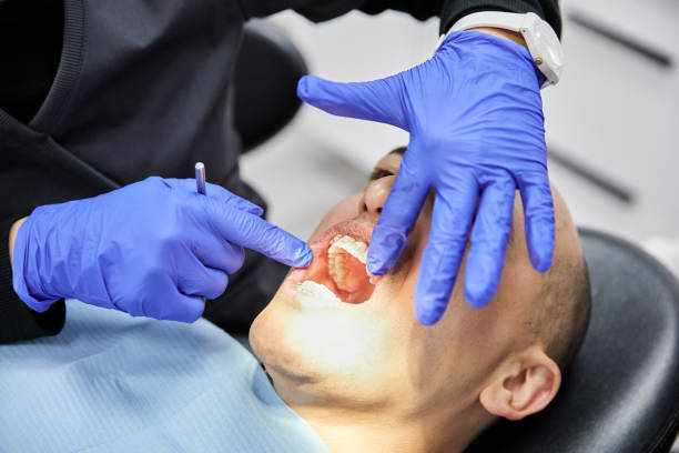 Best Emergency Dental Care for Broken or Chipped Teeth in Joppatowne, MD